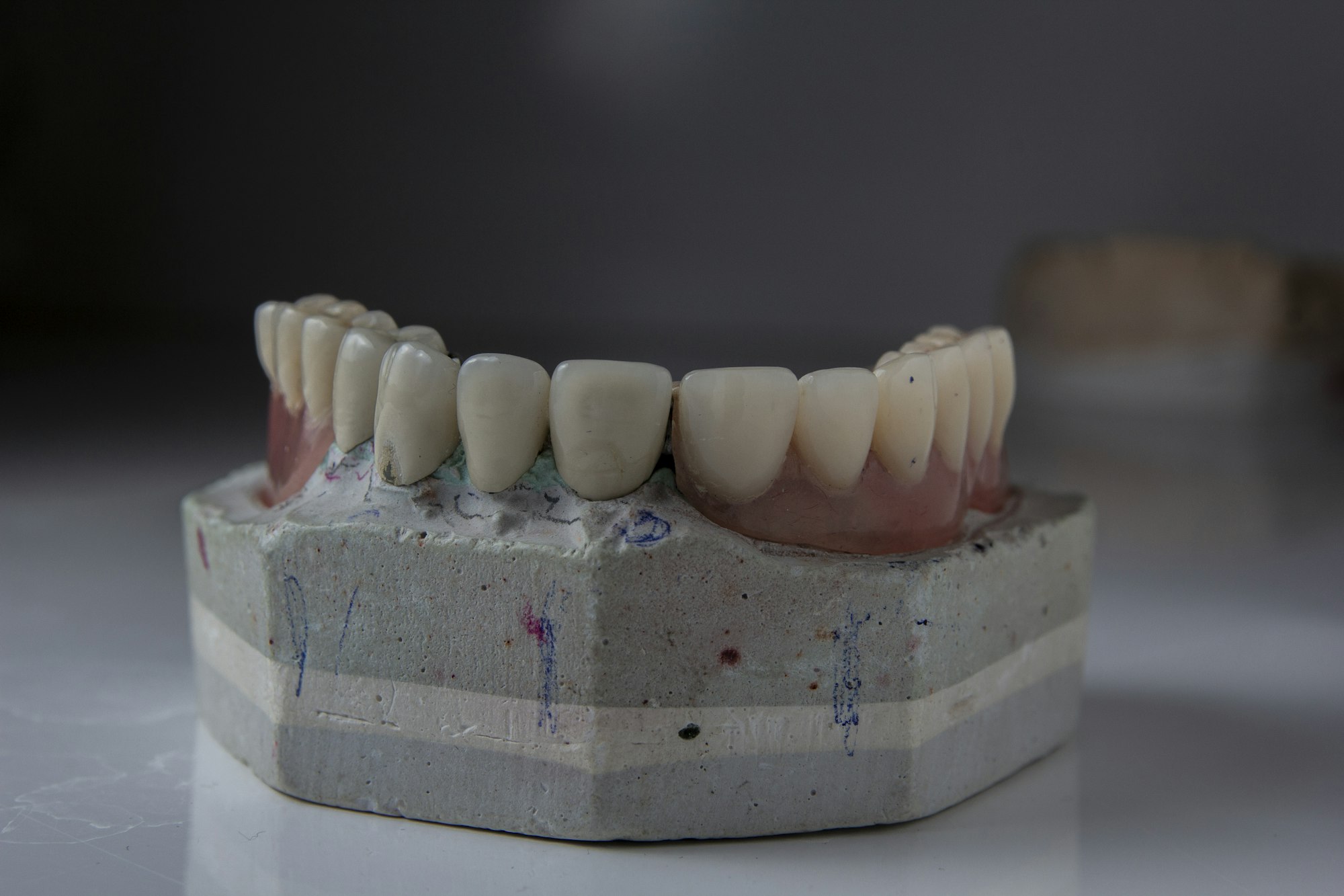 A close-up of a tooth model on a table