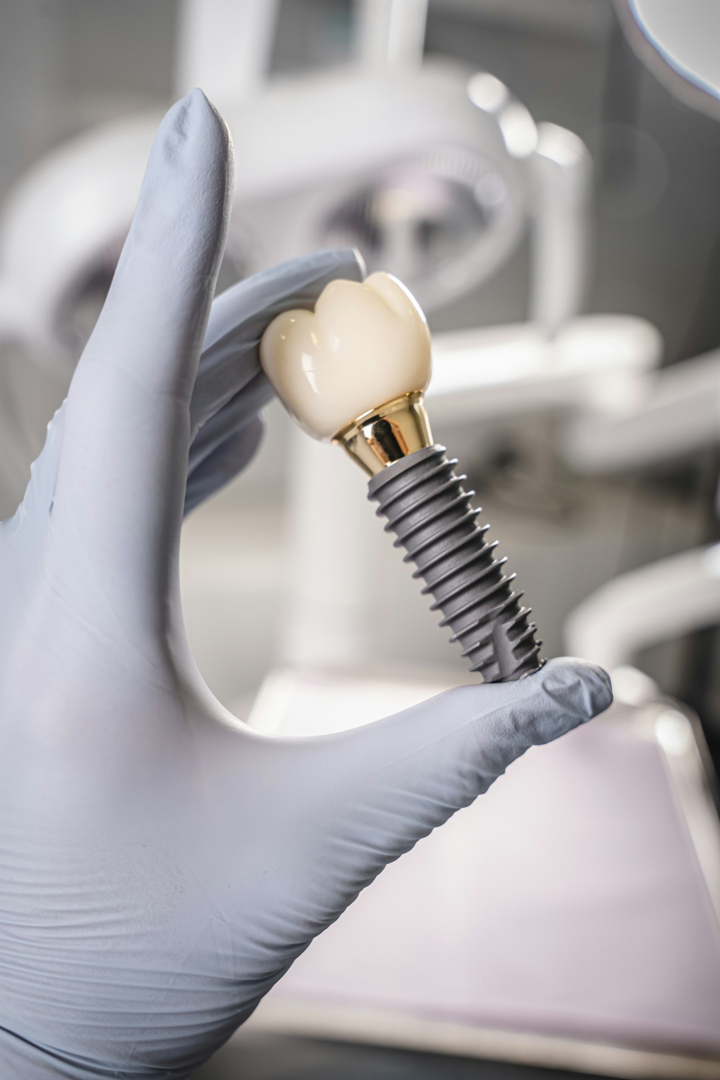 A gloved hand holding a dental implant and crown